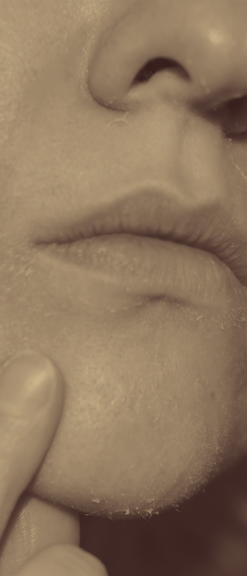 person with dry skin on their face/ chin